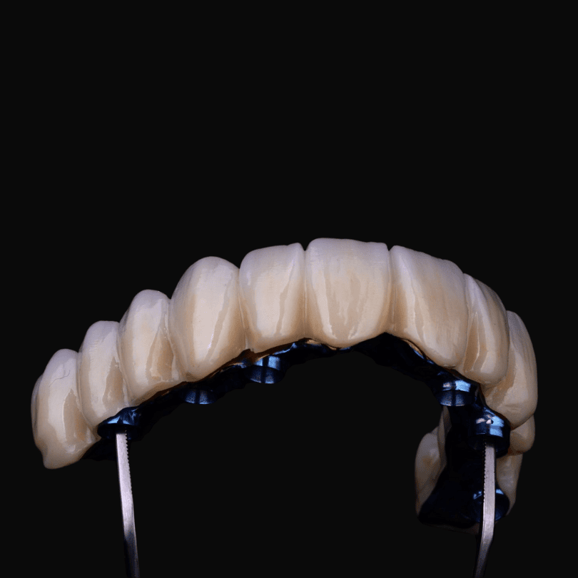 Zirconia full arch provides a strong, durable, and natural-looking full-arch restoration supported by implants.